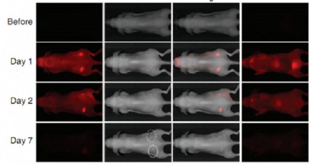 Tratamento infravermelho destri o cncer sem as sequelas da quimioterapia