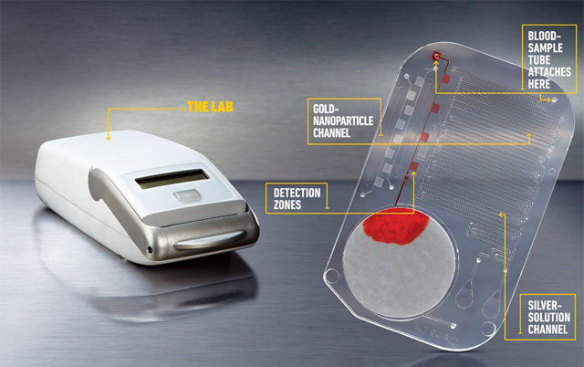 Desenvolvem um chip de 11 dlar para detectar o HIV e outras doenas em 15 minutos